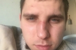 В Саратове избит гражданский активист Евгений Ширманов