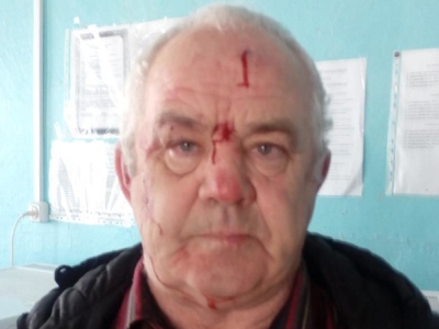 Пенсионер пожаловался в полицию на нападение депутата