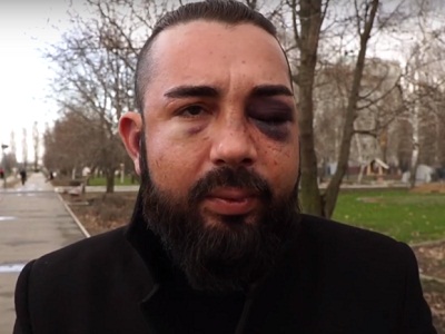 В Балакове азербайджанец заявил об избиении толпой в клубе: Думали, что русский