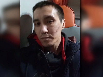 На саратовского фотографа напали неизвестные