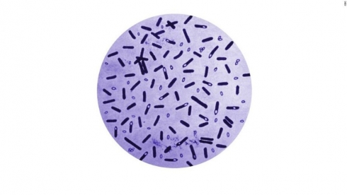 Исследование пищевой продукции на наличие сульфитредуцирующих клостридий