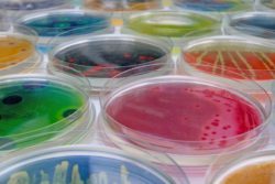 За 2018 год отделом бактериологии, паразитологии и микологии в 193 случаях получен положительный результат