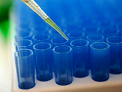 Антитела к возбудителю бруцеллеза — не обнаружены