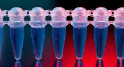 Исследования на инфекционные заболевания методом полимеразной цепной реакции. Получено пять положительных результатов