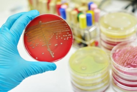 Отделом бактериологии, паразитологии и микологии Саратовской МВЛ проведено 1611 исследований