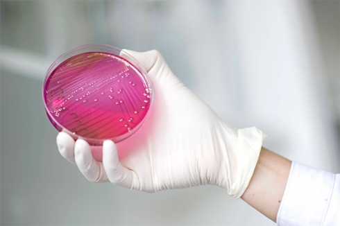 В пробах яиц и цыплят выявлены стрептококки и кишечная палочка