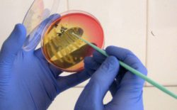 За 3 квартал 2017 года отделом бактериологии, паразитологии и микологии выделено 108 положительных результатов