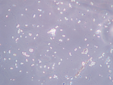 Обнаружены возбудители нозематоза и варроатоза пчел