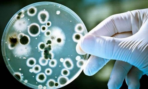 Обнаружена Listeria monocytogenes в мясе