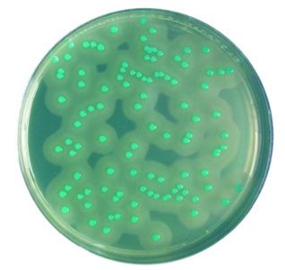 Саратовская МВЛ проводит исследования пищевых продуктов на наличие листерий