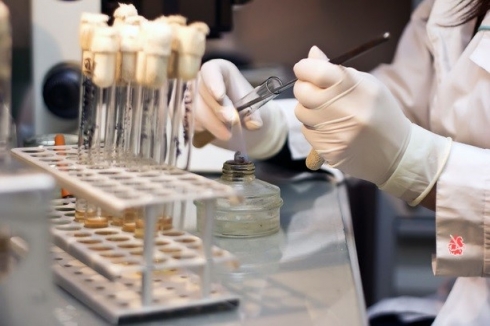 При бактериологическом исследовании кормов положительных результатов не выявлено