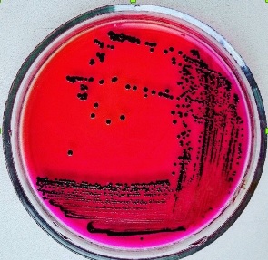 В пищевых продуктах бактерий из рода Salmonella не обнаружено