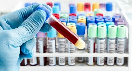 Для исследования по государственному заданию и мониторингу поступило 1529 проб