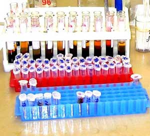 Выполнение плана в отделе серологии и диагностики лептоспироза за 2018 год