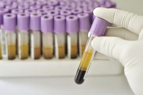 Подведены итоги отдела серологии и диагностики лептоспироза саратовской ветлаборатории за 8 месяцев 2019 года