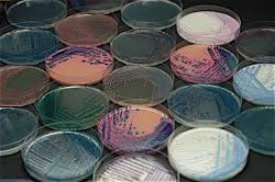 За 8 месяцев 2018 года отделом бактериологии, паразитологии и микологии выделено 106 положительных результатов