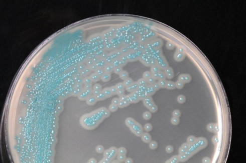 Саратовская МВЛ: В пробах патологического материала от свиней возбудитель листериоза не выделен