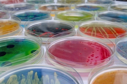 За 1 квартал 2019 года отделом бактериологии, паразитологии и микологии выделено 56 положительных результатов