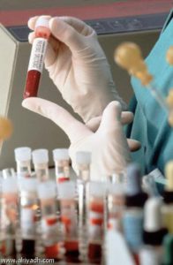 Итоги работы отдела серологии и диагностики лептоспироза Саратовской МВЛ