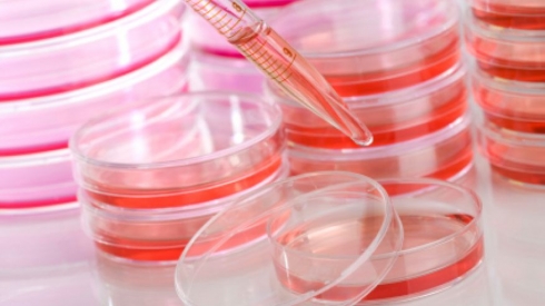 Исследование пищевых продуктов на наличие дрожжей