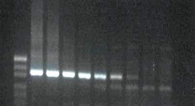 ПЦР-диагностика — современный высокотехнологичный метод исследования