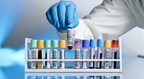 Отмечена эффективная иммунизация птицепоголовья