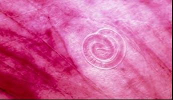 В пробах материала от свиней ветлаборатория трихинеллёз не обнаружила