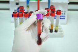 В саратовской ветлаборатории проведены биохимические исследования сыворотки крови сельскохозяйственных животных