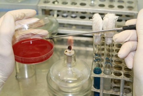 В 25 пробах патологического материала отделом бактериологии, паразитологии и микологии ФГБУ «Саратовская МВЛ» возбудитель рожи свиней не выделен