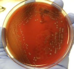 Выделен стрептококк!