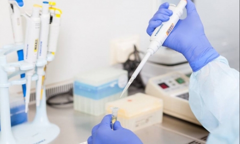 В рамках государственного эпизоотологического мониторинга и государственного задания саратовской ветлабораторией выявлен лептоспироз