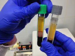 Биохимическое исследование сыворотки крови