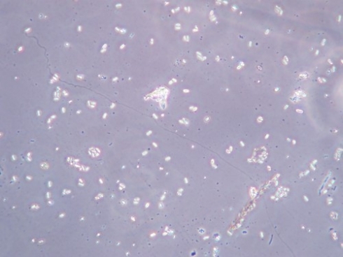 Возбудитель нозематоза в поморе пчел не обнаружен