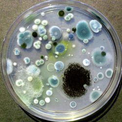 Саратовская МВЛ: Плесени и дрожжи не обнаружены