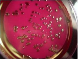 Саратовская ветлаборатория: Выявлен возбудитель колибактериоза