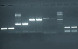 Исследования методом полимеразной цепной реакции – получено 2 положительных результата