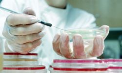 Обнаружены микроорганизмы, вызывающие заболевание маститом