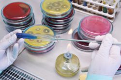 За 10 с половиной месяцев отделом бактериологии, паразитологии и микологии выделено 145 положительных результатов