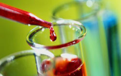 О работе отдела вирусологии и гематологии с начала 2 квартала 2018 г