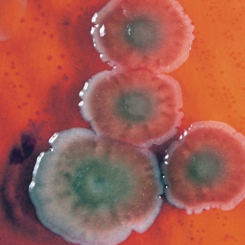 Чем опасен псевдомоноз?