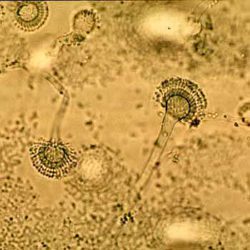 Аспергиллез не обнаружен!