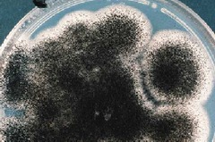 В пробах подстилочного материала обнаружен аспергиллез