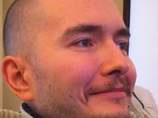 Россиянин согласился на операцию по пересадке головы